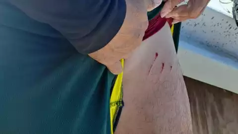 ATAQUE de lagarto contra pescador en Dzilam de bravo (FOTO)