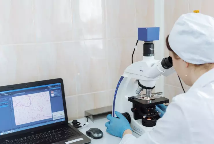 Un médico observando el microscopio y registrando los datos en su computadora para la detección de la bacteria Klebsiella oxytoca en Edomex.