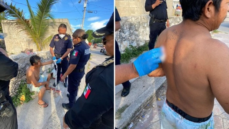 Hombre es HERIDO en Umán tras presunto PLEITO marital