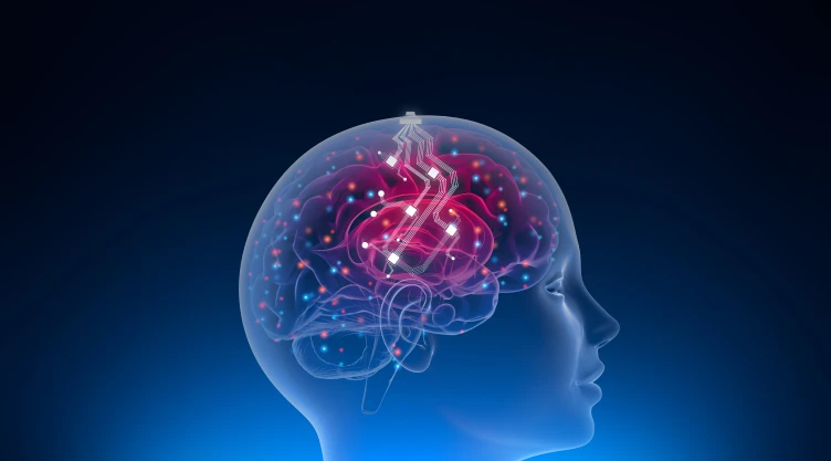 Neuralink implanta quirúrgicamente algunos componentes de la computadora en la superficie de su cerebro para la conexión de red neuronal entre el software y el hardware