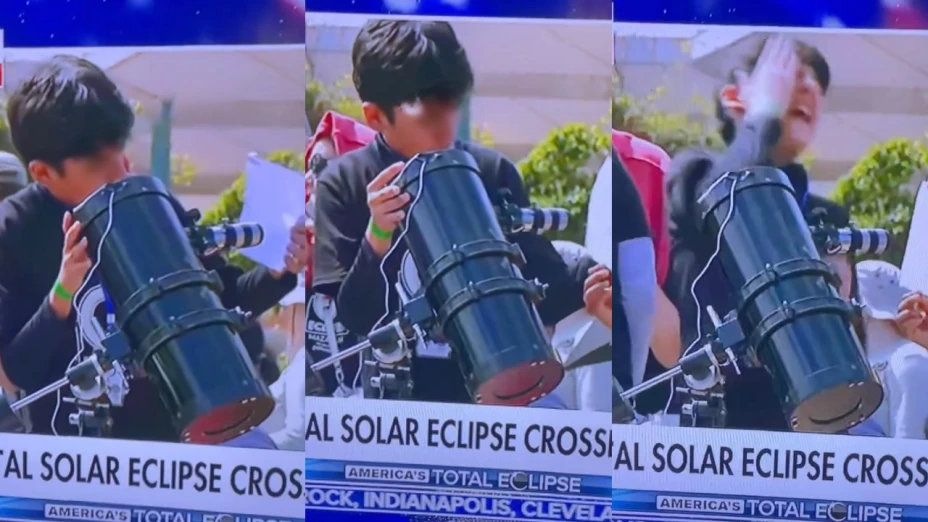 Niño sufre daño con el eclipse