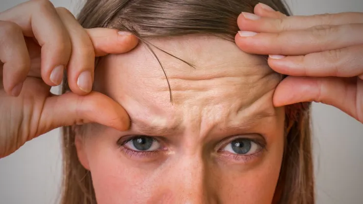 Trucos de belleza 3 ideas creativas para disimular una frente amplia sin flequillo.jpg