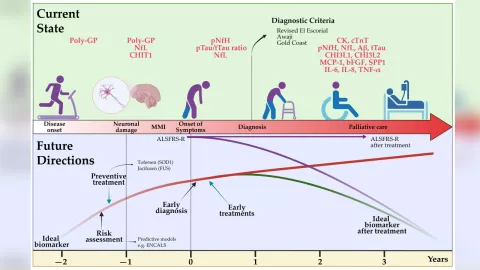 esclerosis lateral amiotrófica