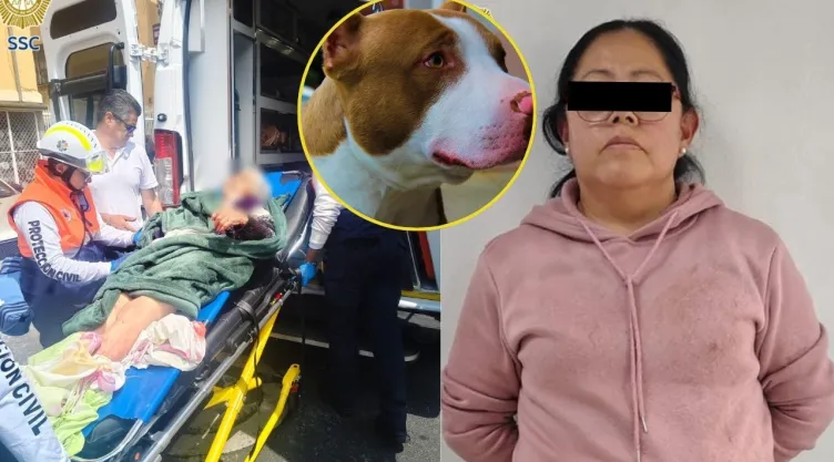 Ataque de pitbull en Iztapalapa: anciana de 73 años pierde parte del brazo