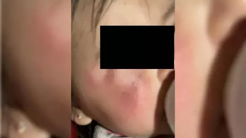 Guardería entrega a bebé fuertemente golpeada, en Mérida (FOTOS)