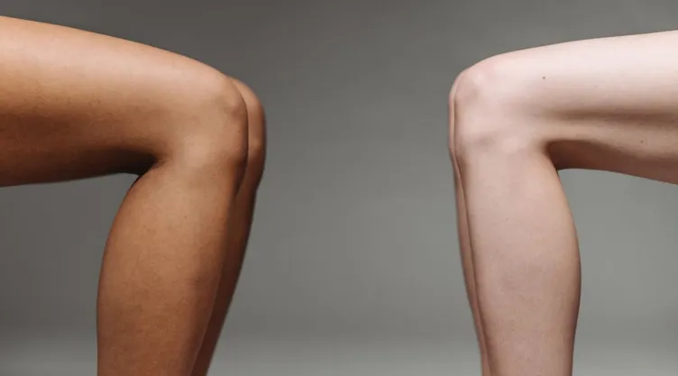 ¿Qué exfoliantes caseros suavizan la piel de los codos y rodillas oscurecidas?