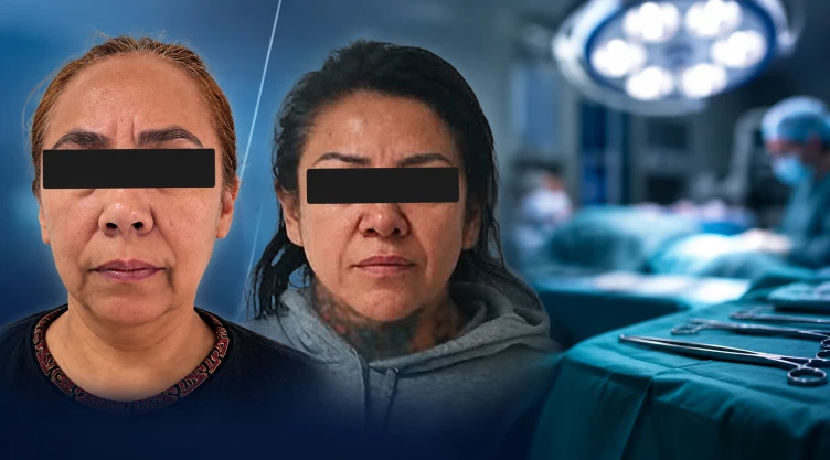 Muere mujer en cirugía estética en CDMX y detienen a dos presuntas implicadas.