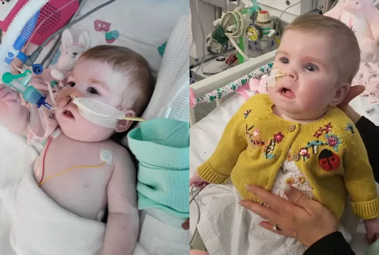 indi-gregory-bebe-inglaterra-enfermedad-mitocontrial