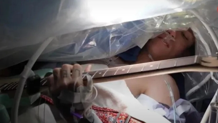 VIDEO-Extirpan-tumor-cerebral-a-joven-mientras-toca-la-guitarra
