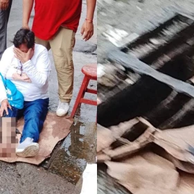 mujer-sufre-grave-lesion-por-alcantarilla-rota-en-veracruz-donde-denunciar