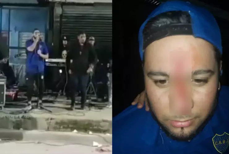 Cantante agredido con aire comprimido