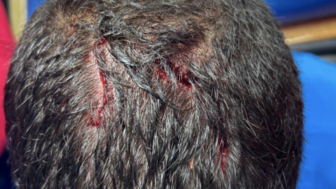 Cabeza de Nacho Rivero tras el partido Cruz Azul vs Xolos.jpg