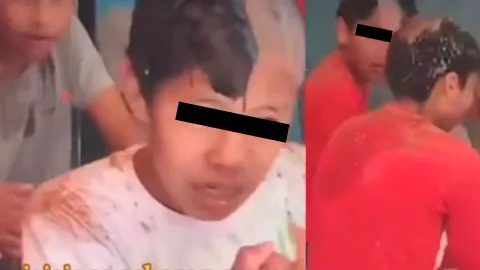 Niños confunden shampoo con crema depiladora y se quedan pelones