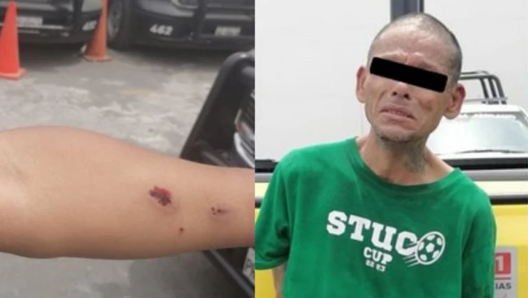 Ladrón ataca a mordidas a policías de Monterrey