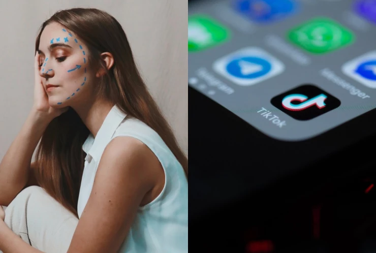 cirugias-esteticas-tik-tok-filtros-bold-glamour