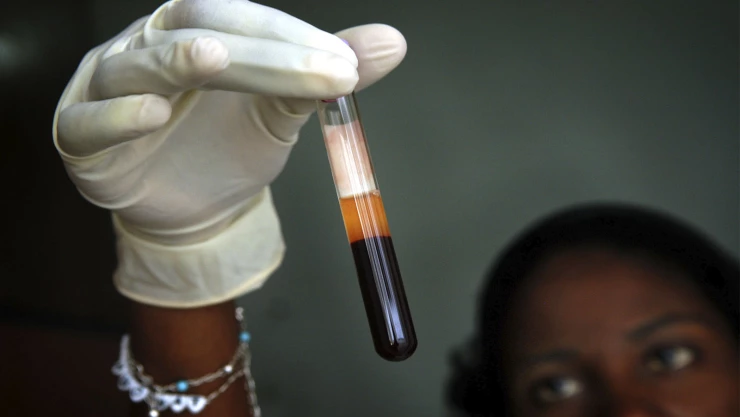 9. Curas para cáncer y SIDA