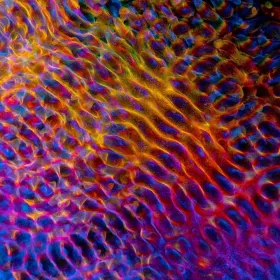 LSD y cerebro: qué efectos puede tener después del “viaje”