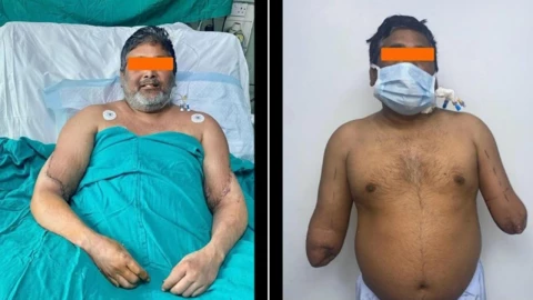 mujer dona brazos manos pintor india fotos