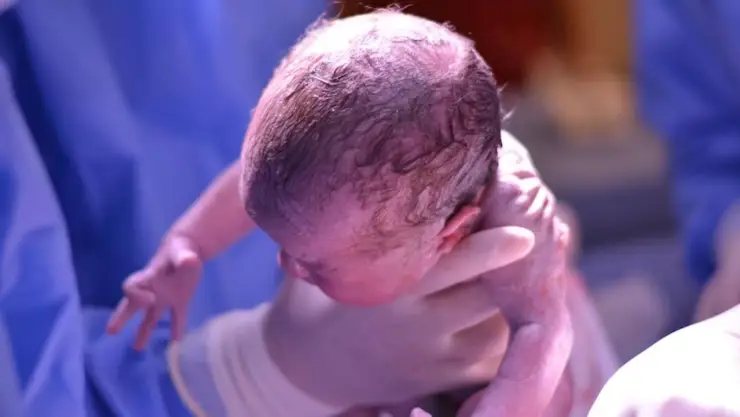 Nace el primer bebé de una mujer con útero trasplantado