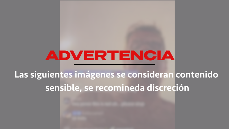 Perez Hilton hospitalizado tras incidente en TikTok: qué pasó y reporte médico