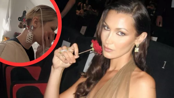 Enfermedad de Lyme: el diagnóstico que enfrenta la supermodelo Bella Hadid