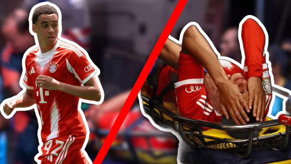 Bayern revela crudos detalles de la lesión de Jamal Musiala; será ‘baja larga’.jpg