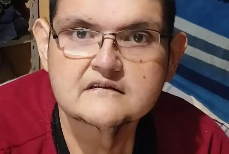 ¿Quién era Juan Pedro Franco el hombre más obeso del mundo originario de Aguascalientes