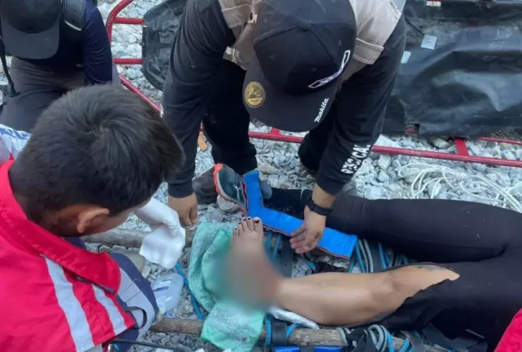 Fractura expusta.jpg