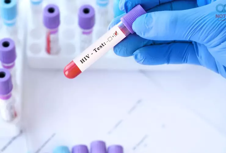 VIH/Sida en México: Casos diagnosticados y los estados con más contagios