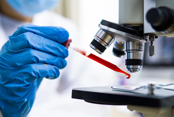 El nuevo análisis de sangre para detectar el cáncer de colon