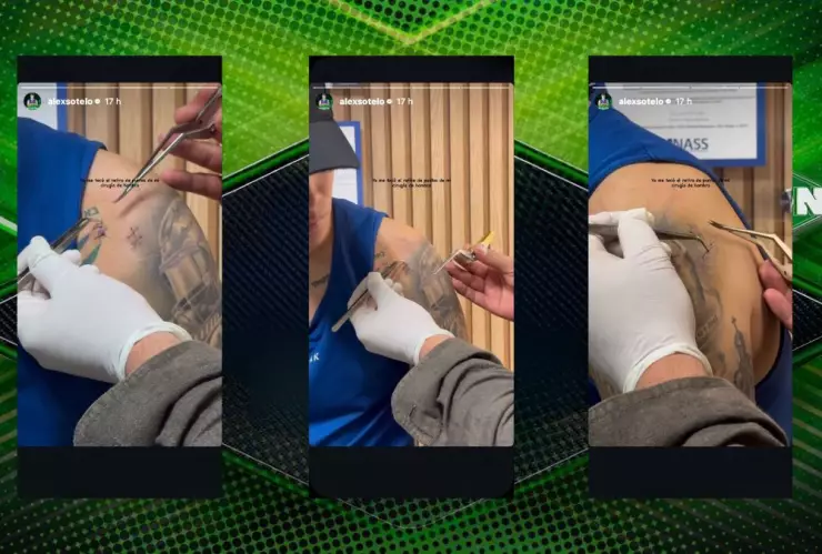 Así se encuentra Alex Sotelo de la terrible cirugía que tuvo que enfrentar tras su lesión dentro de Exatlón México