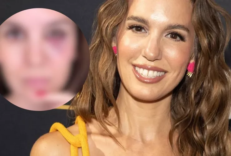 Famosa actriz de Disney Channel recibió un disparo en el rostro; esto es lo que sabemos