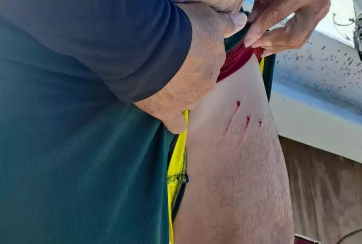 ATAQUE de lagarto contra pescador en Dzilam de bravo (FOTO)