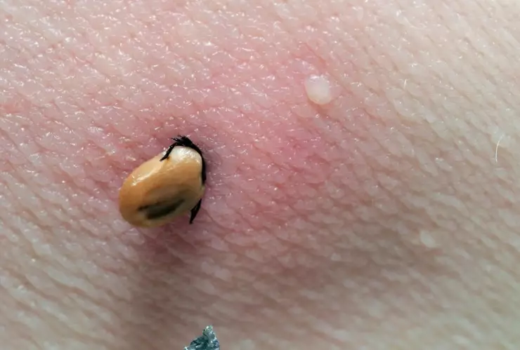 SSa hace un llamado para prevenir la enfermedad Rickettsia