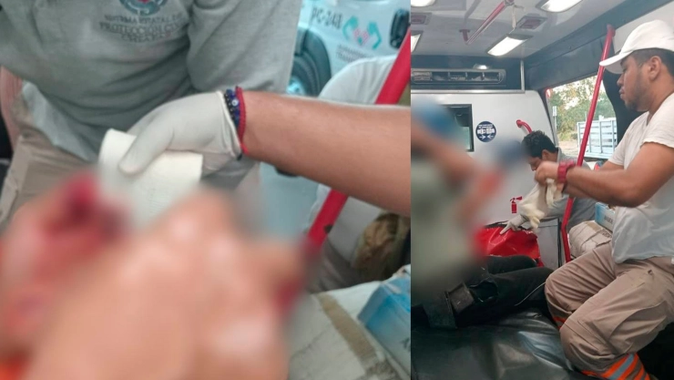 Amputación pirotecnia Tonalá