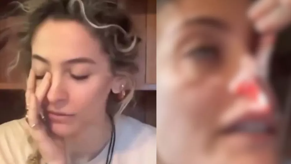 Paris Jackson muestra perforación nasal causada por drogas: explica por qué no se someterá a cirugía