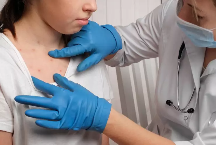 Una niña siendo analizada ya que presenta sintomas del virus mpox y la médica le toca el pecho