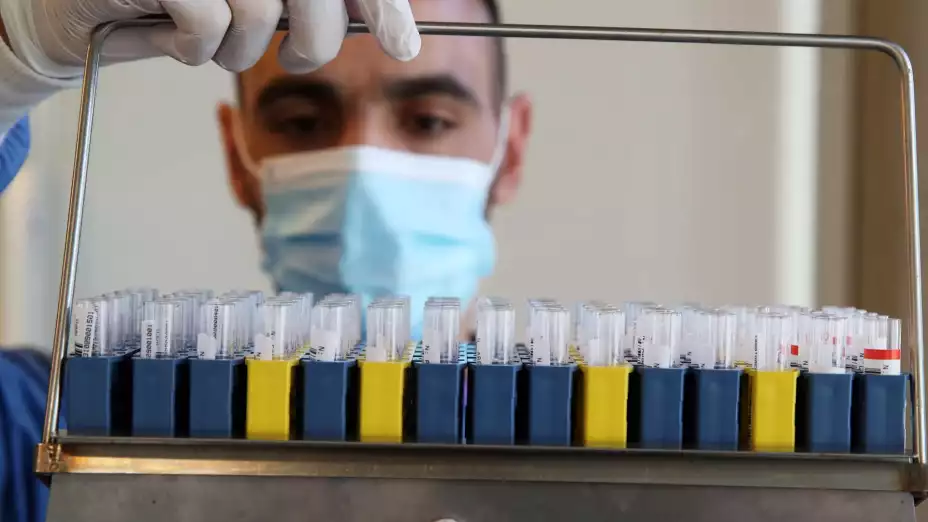 PRUEBA PCR.jpg