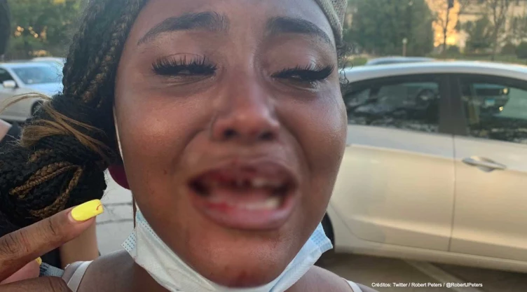 mujer golpeada policia dientes.jpg