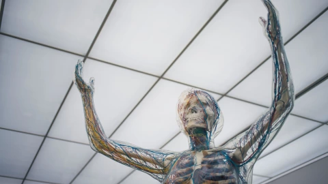 que es el síndrome de de persona ríguida