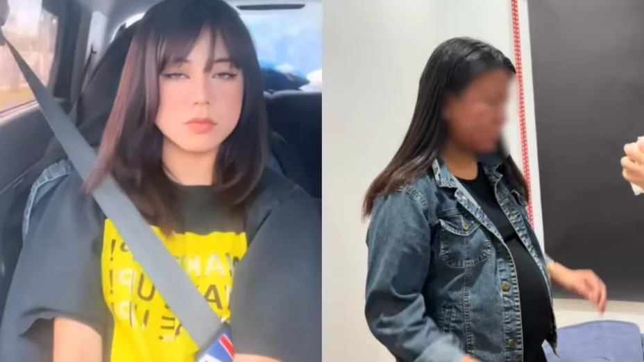 VIDEO | Joven sufre grave deformación en el rostro por el embarazo