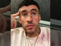 Bad Bunny Pensativo.jpg