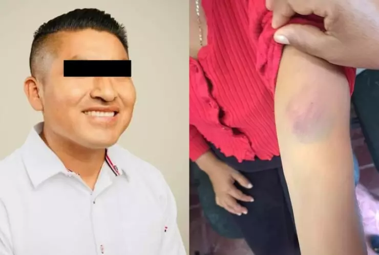 FGE investiga a alcalde en Guerrero por golpear a su esposa