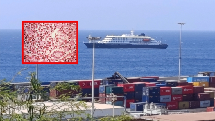 VIDEO interior crucero brote letal de hantavirus