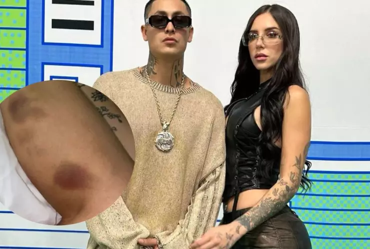 ¿Se refiere a Alemán_ Su novia Akasha comparte fotos con golpes y audio de pelea.jpg