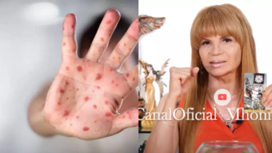 ¿Llegará la viruela de mono a México , esto dice Mhoni Vidente