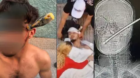 Joven termina con destornillador en la cabeza tras intensa riña de “ajuste de cuentas”