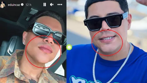 Eduin Caz antes y después