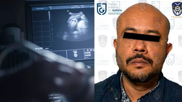 Detienen a médico que operó a mujer sin estar embarazada