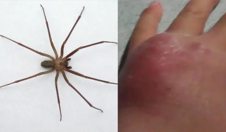Temporada de araña violinista 2025: ¿Cuándo es y qué hacer ante una mordedura?